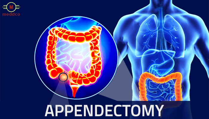 Appendicitis Causes, Symptoms and Treatment