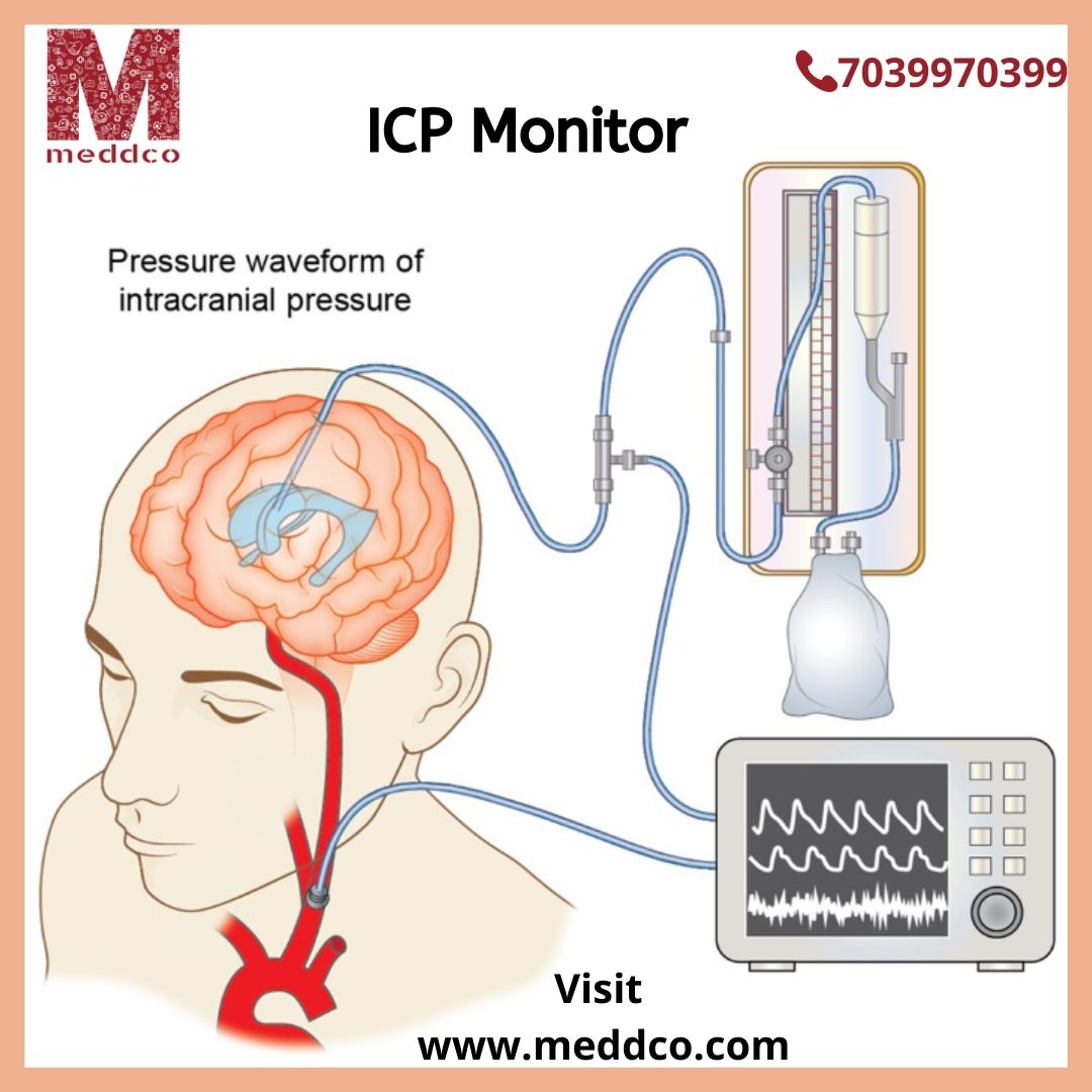 Placement of ICP Monitor- an overview