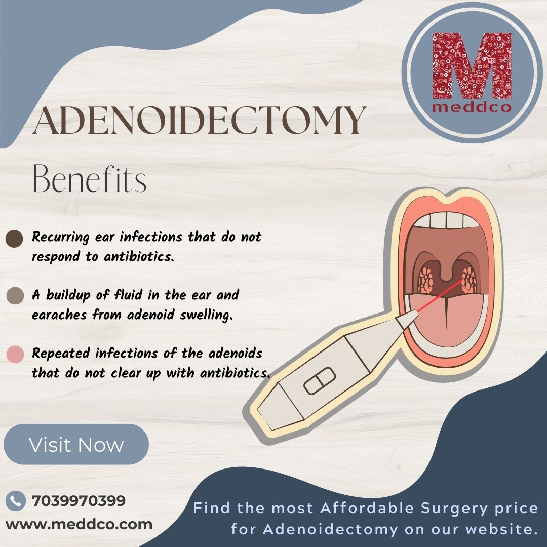 What are the benefits of having adenoids removed?