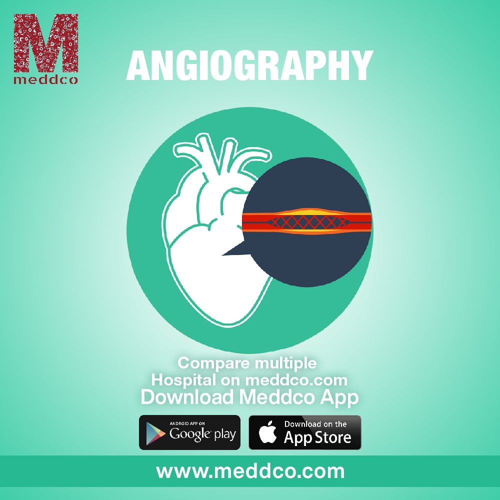 articles/Angiography_6-min_(1).jpg