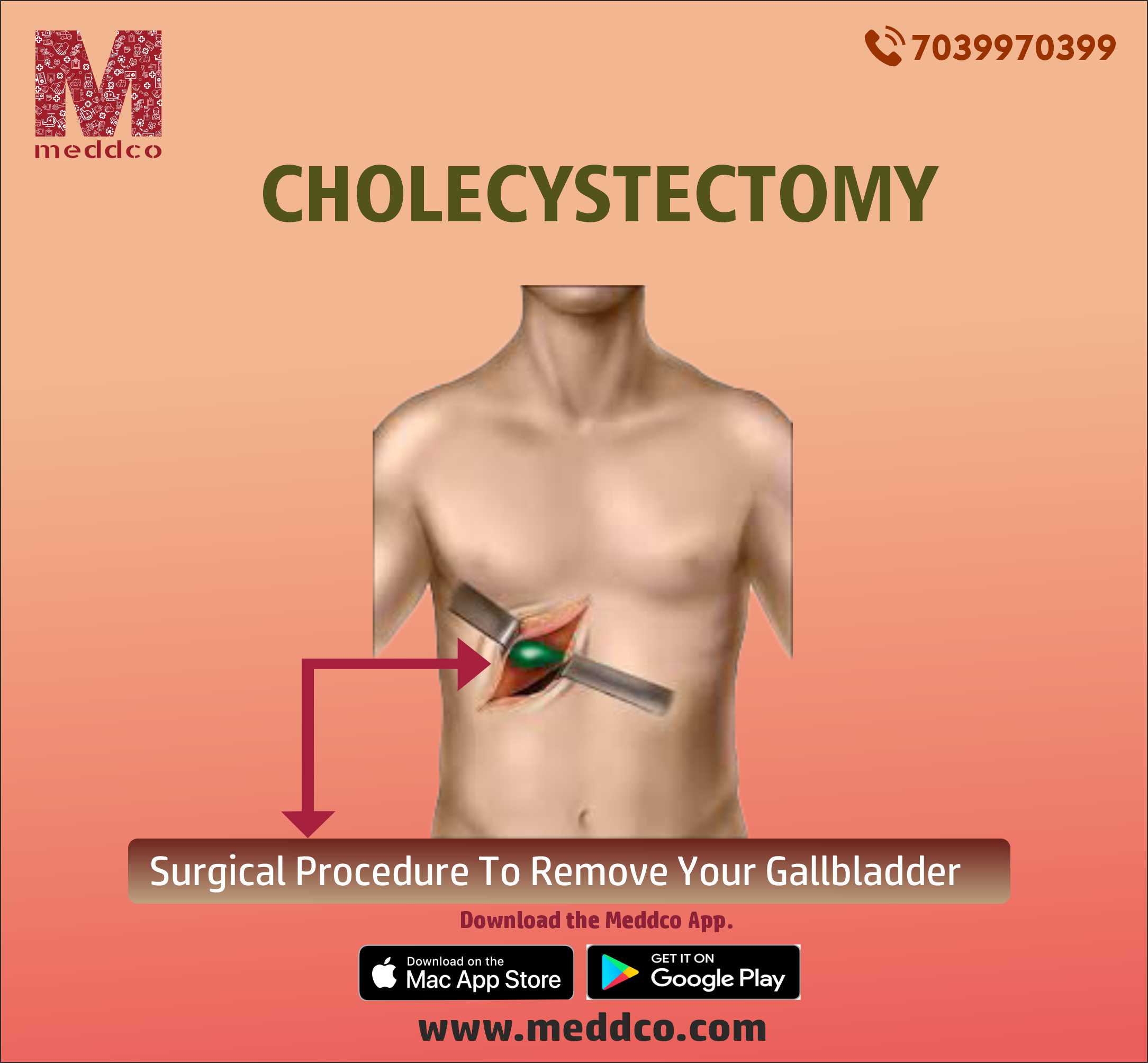 HOW TO PREPARE FOR THE GALLBLADDER SURGERY OR CHOLECYSTECTOMY 