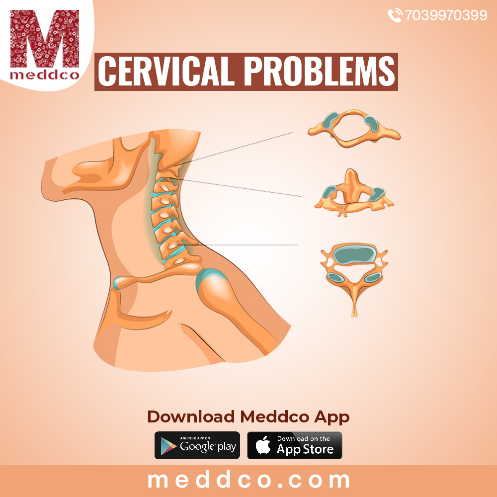 articles/Cervical_problems_1.jpg