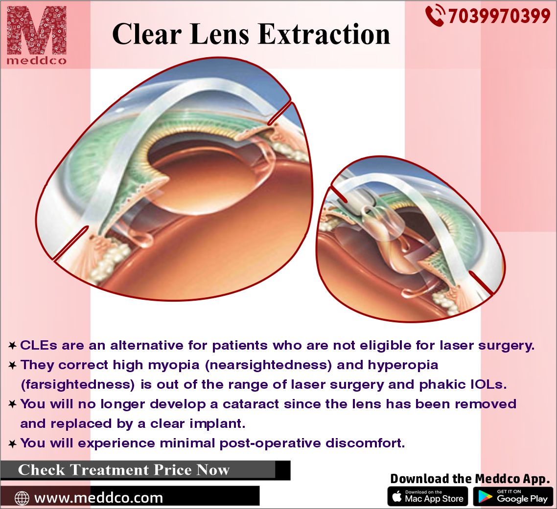A brief overview of Clear Lens Extraction