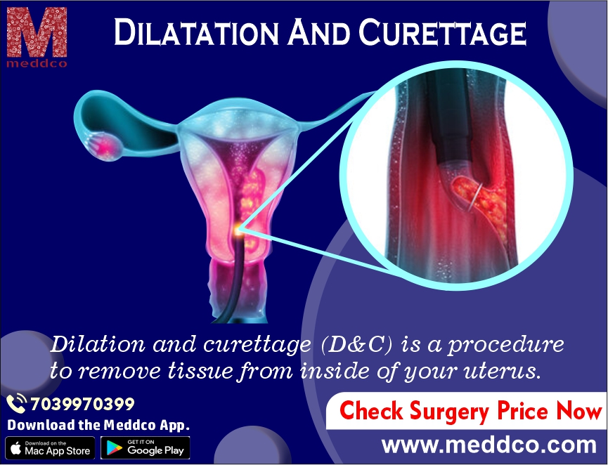 OVERVIEW OF DILATION AND CURETTAGE