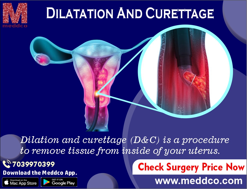 Dilatation and curettage