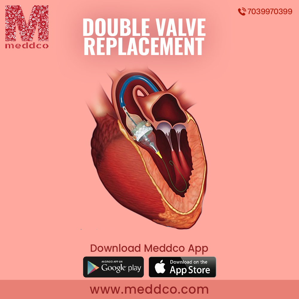 articles/Double_Valve_replacement_1.jpg