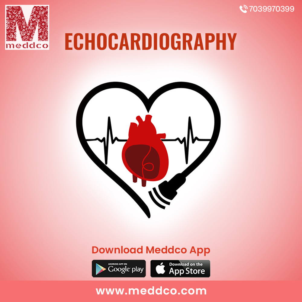 articles/Echocardiography_1.jpg