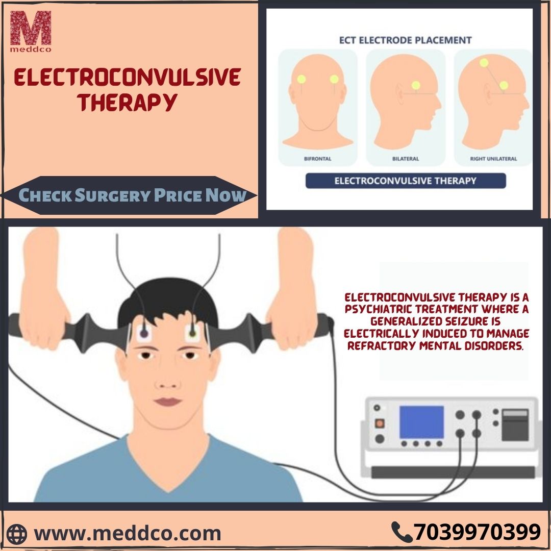 Electroconvulsive Therapy (ECT): Definition, Types, Techniques