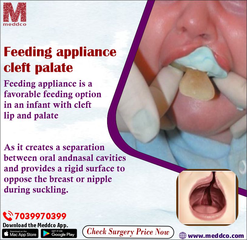 An innovative feeding appliance for your infant.