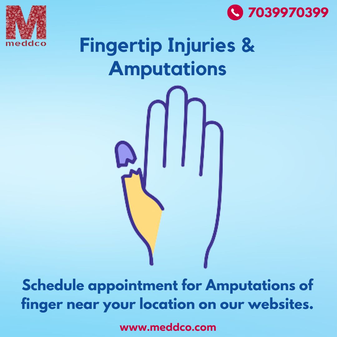 articles/Fingertip_Injuries_&_Amputations.jpg