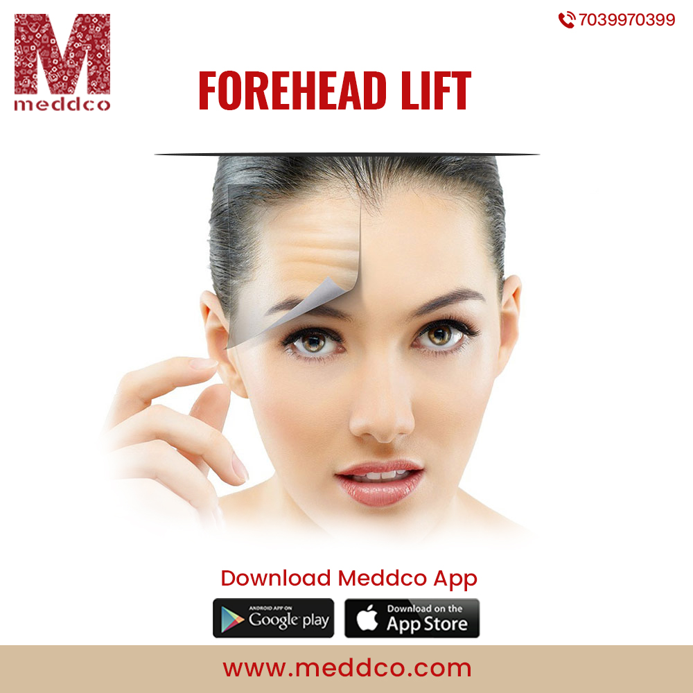 articles/Forehead_lift_2.jpg