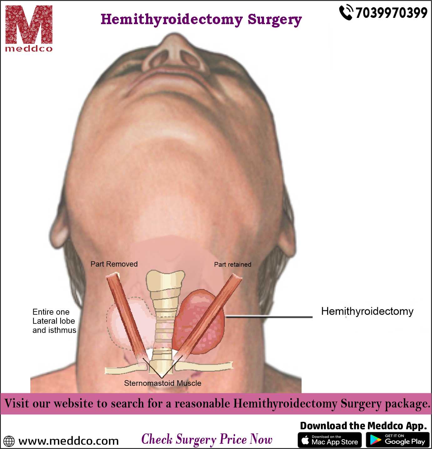 Partial Operation Total Comfort