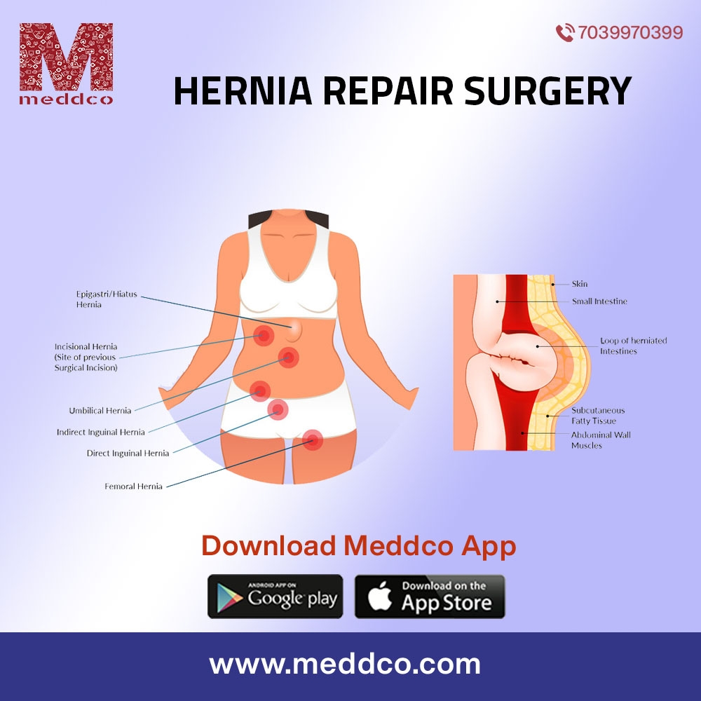 How is a hernia diagnosed?