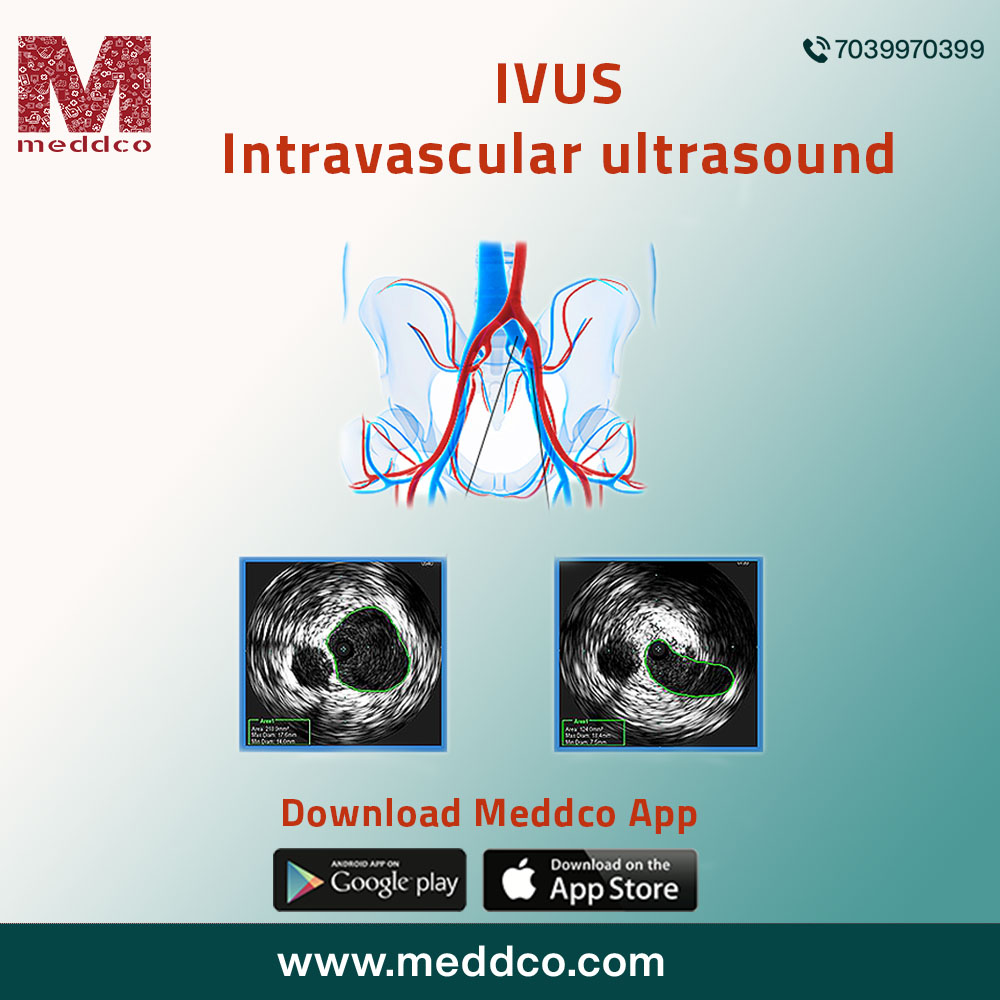 What are the advantages of using intravascular ultrasound?