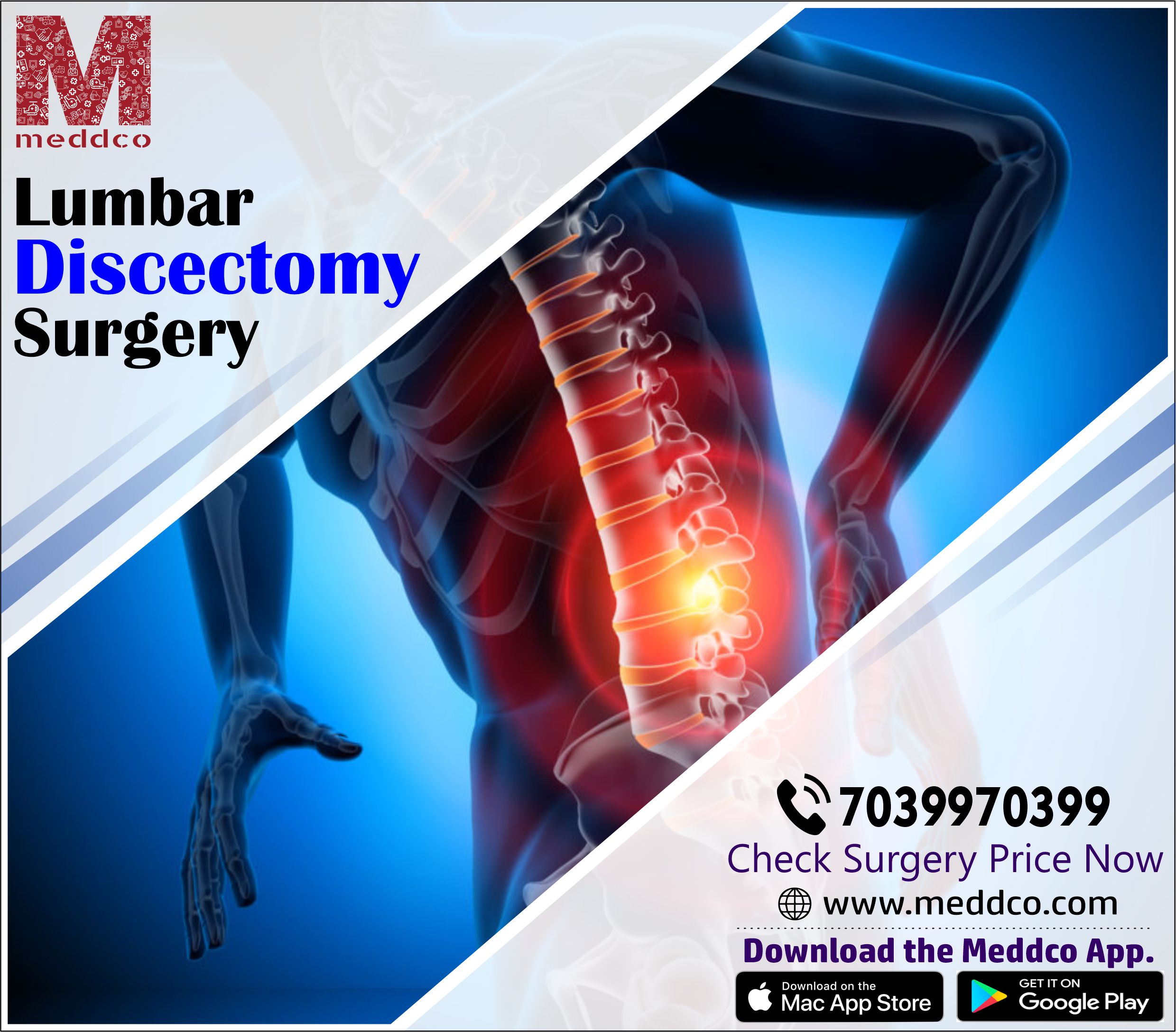 articles/Lumbar_discectomy.jpg