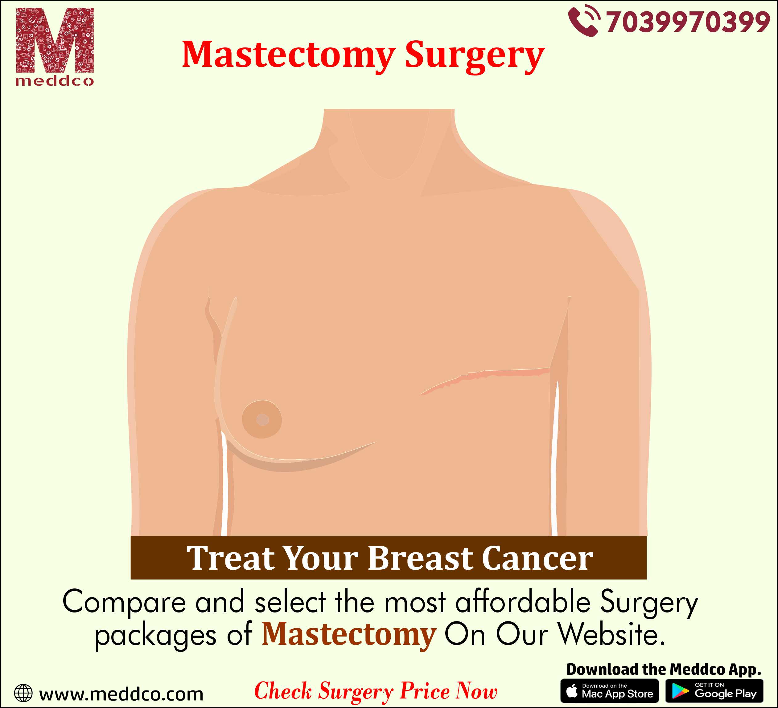 Navigating Choice: Unilateral vs. Bilateral Mastectomy