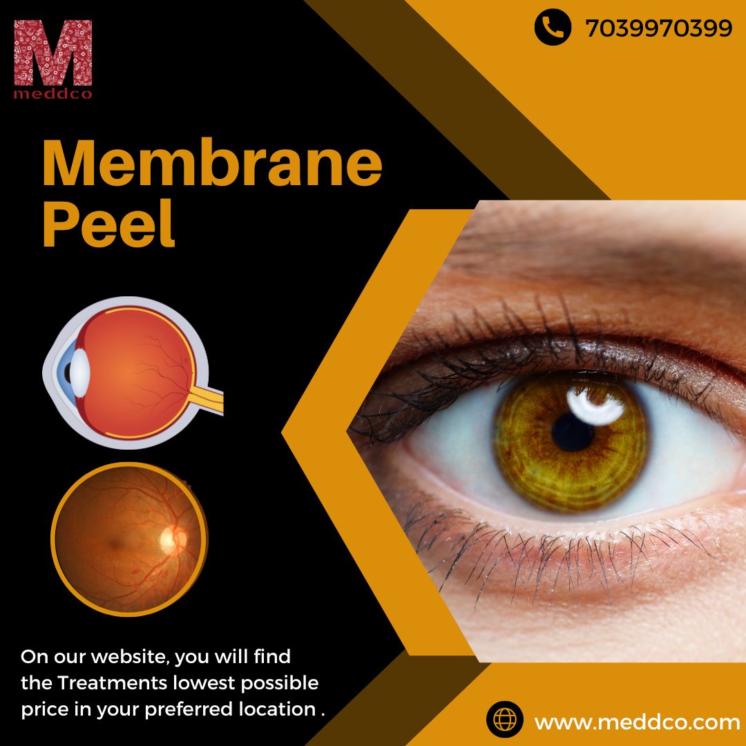 Do I Need a Retinal Membrane Peel?