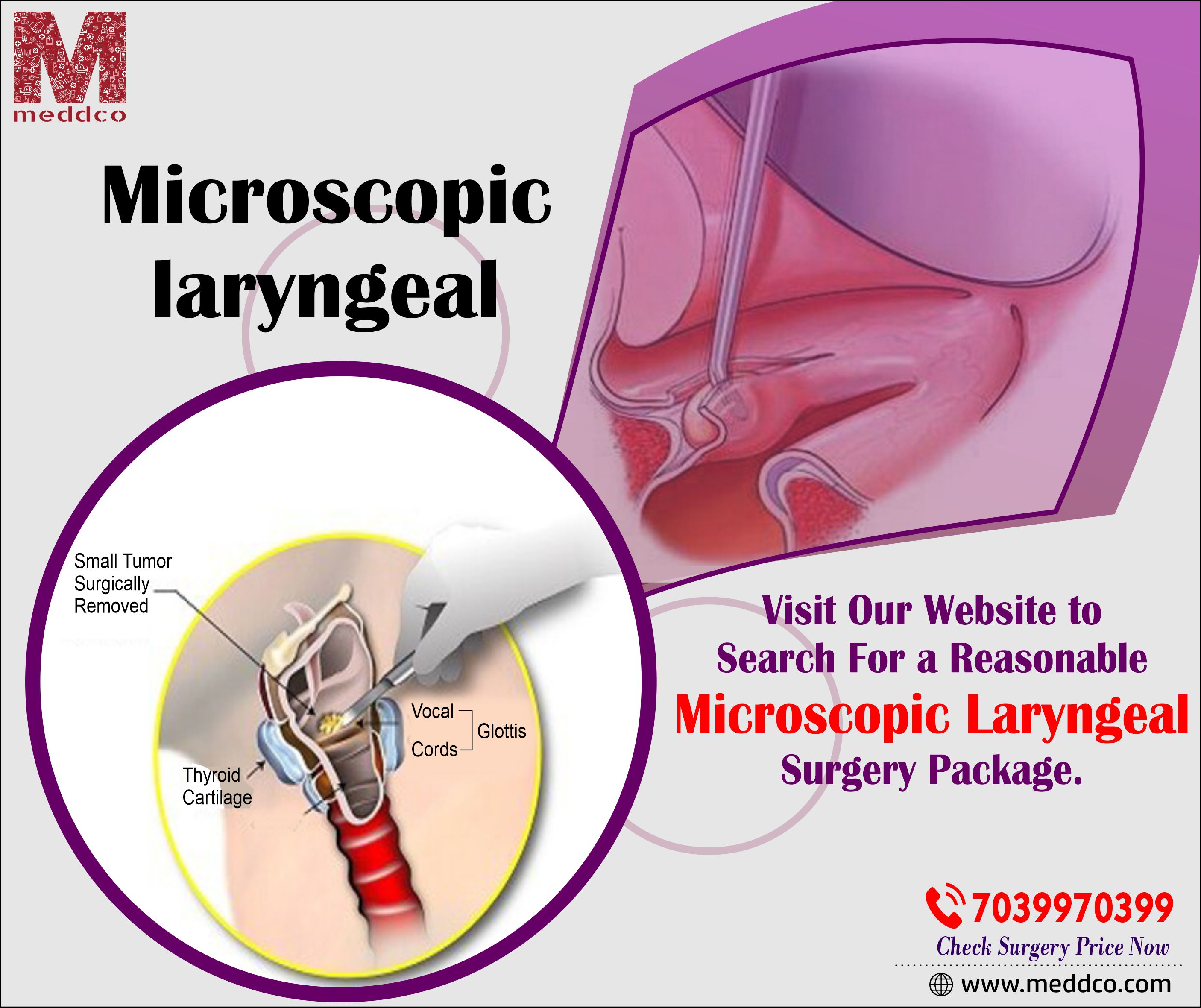 articles/Microscopic_laryngeal.jpg