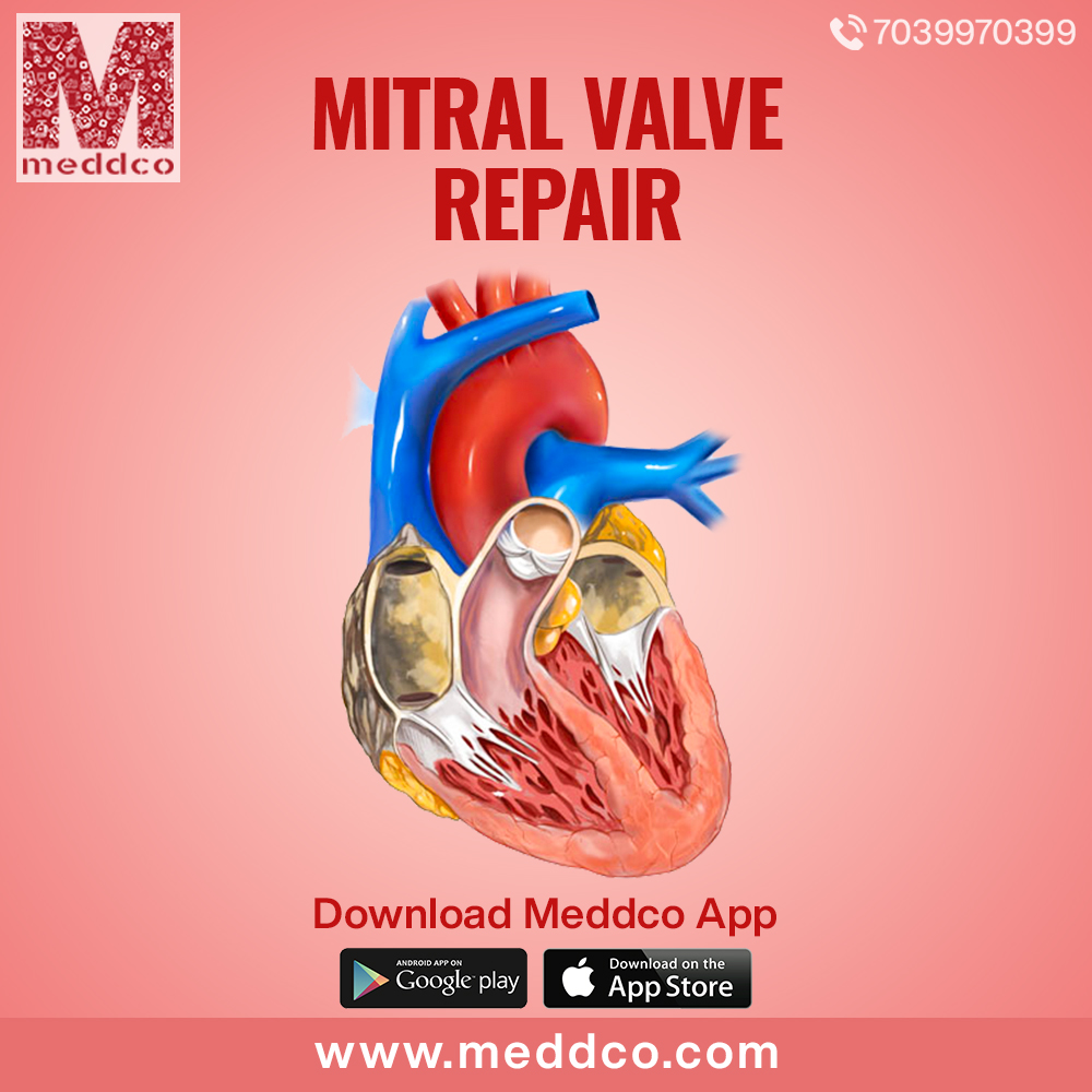 articles/Mitral_valve_repair_1_(1).jpg