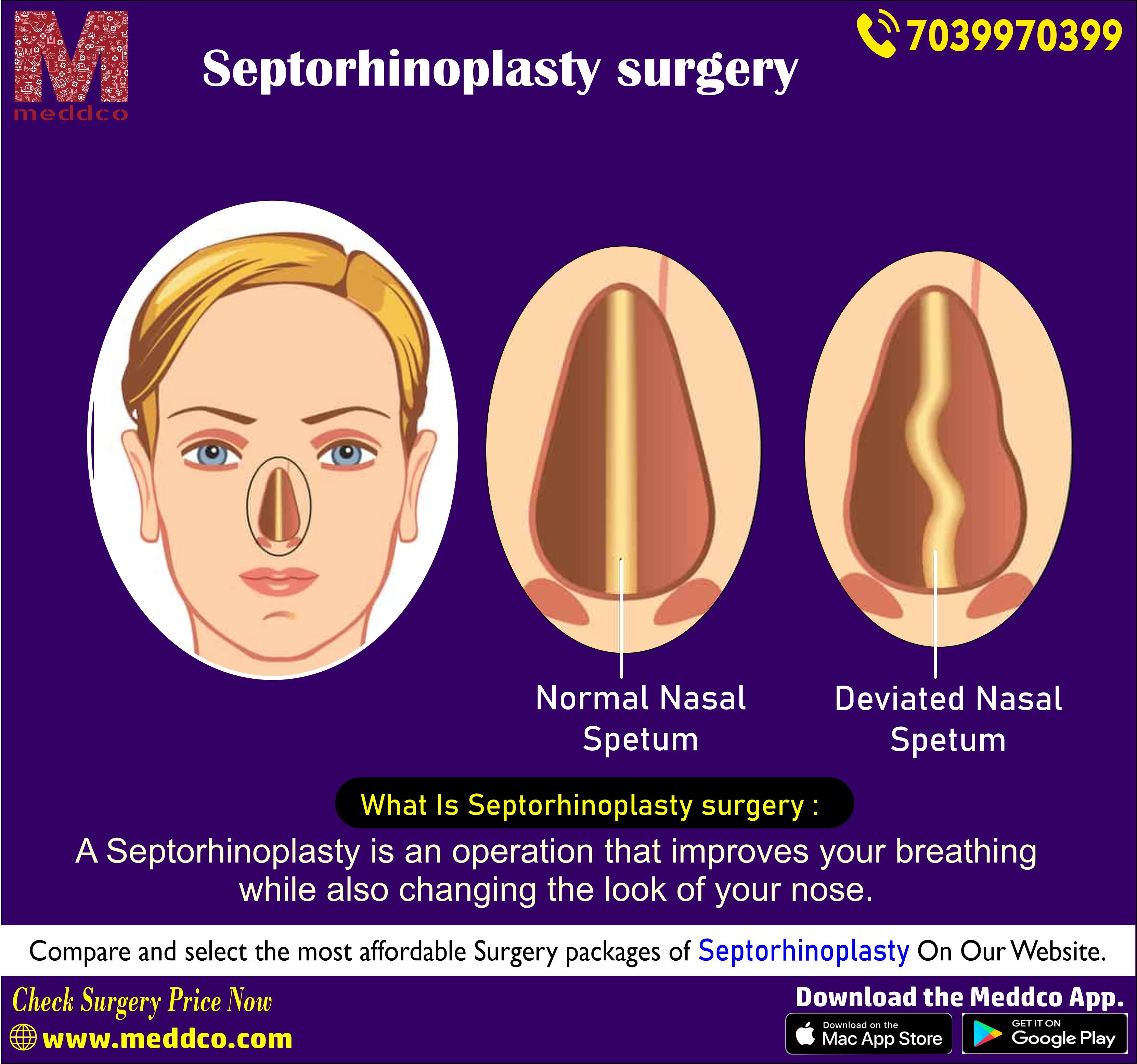 articles/Septorhinoplasty_surgery.jpg