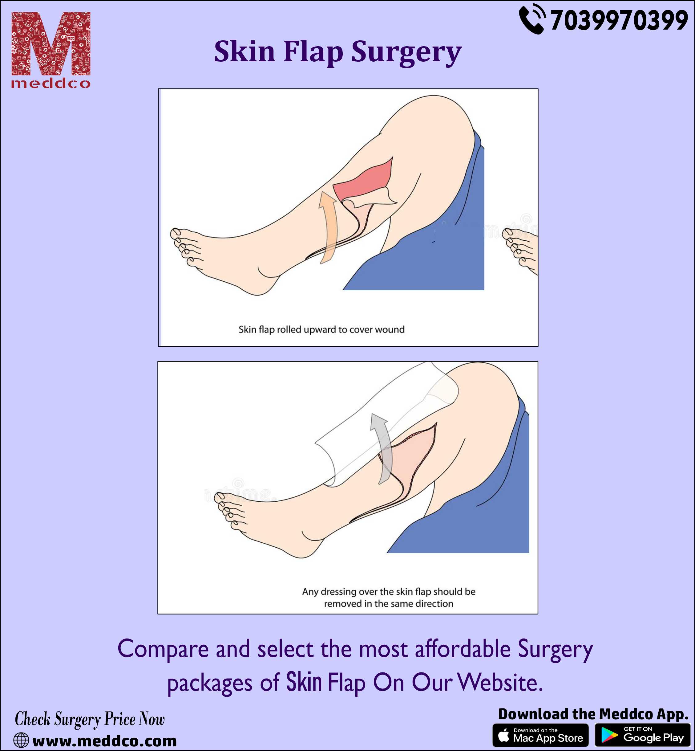 articles/Skin_Flap_Surgery.jpg