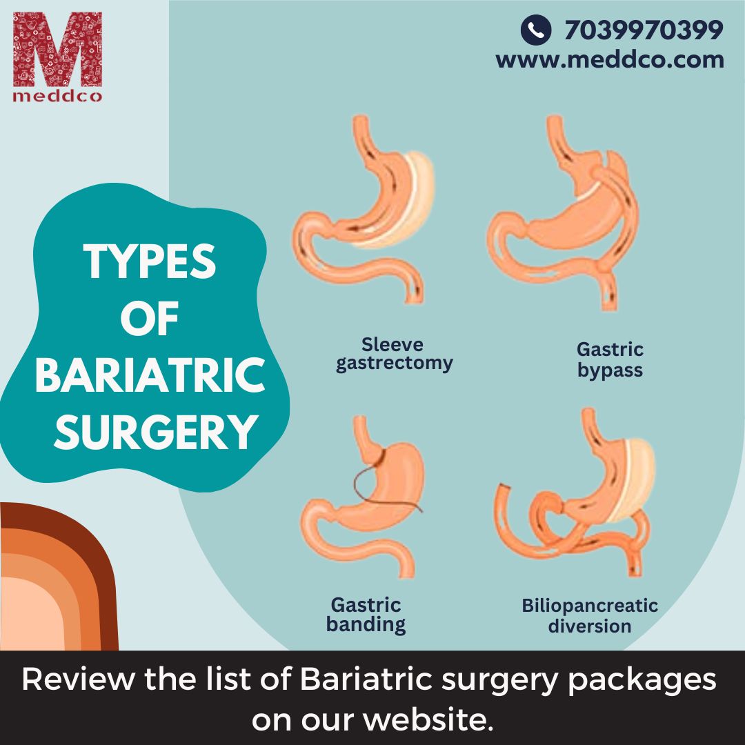 articles/TYPES_OF_BARIATRIC_SURGERY.jpg