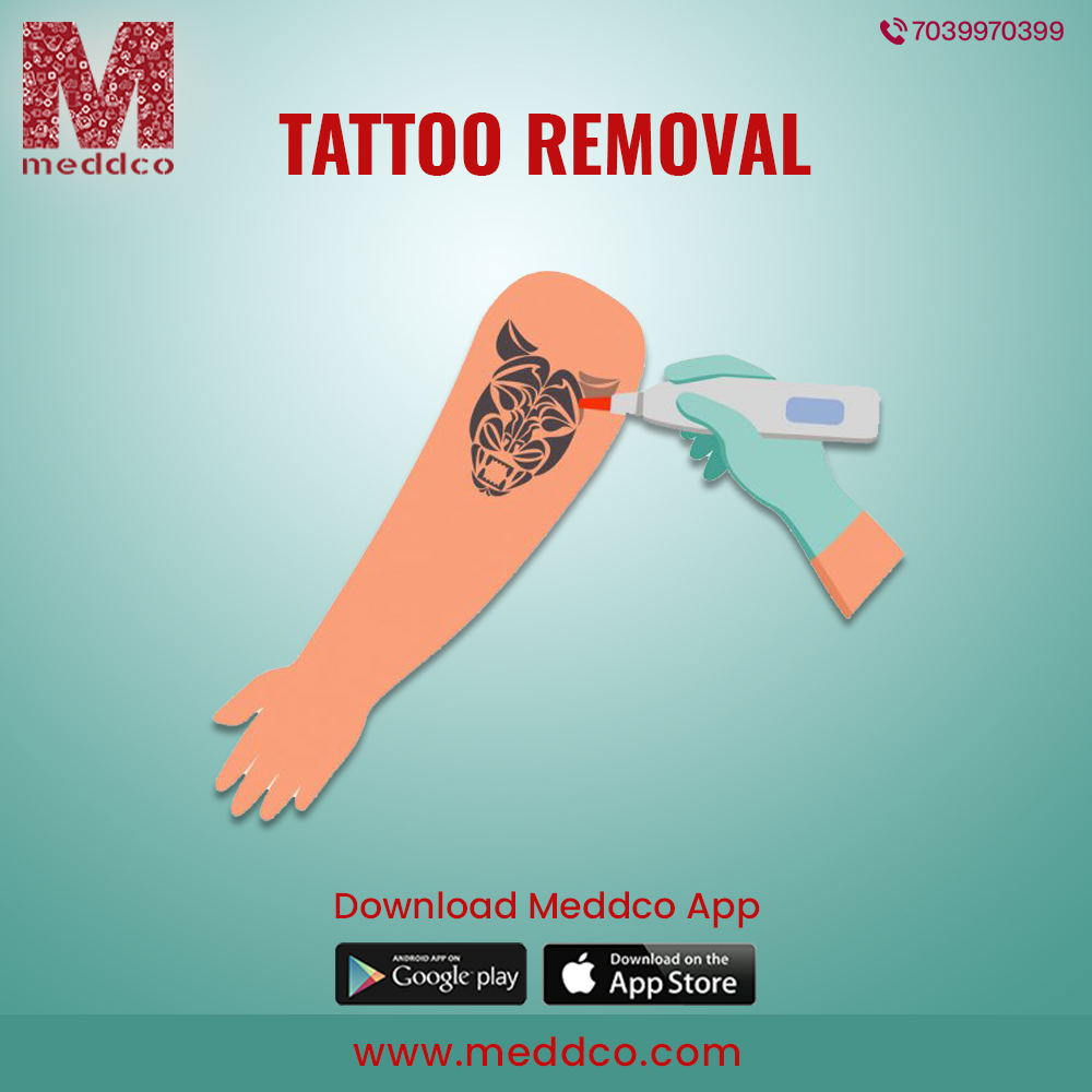 Badyal Hospital - 𝐋𝐚𝐬𝐞𝐫 𝐓𝐚𝐭𝐭𝐨𝐨 𝐑𝐞𝐦𝐨𝐯𝐚𝐥 💁🏻‍♀️ . Erase  Your Regret With Safe & Affordable Tattoo Removal Treatment With Advance  Technology 🏥 . Meet our expert 💁🏻‍♂️ 👩🏻‍⚕️Dr. Jyoti Bhalla M.Ch ,