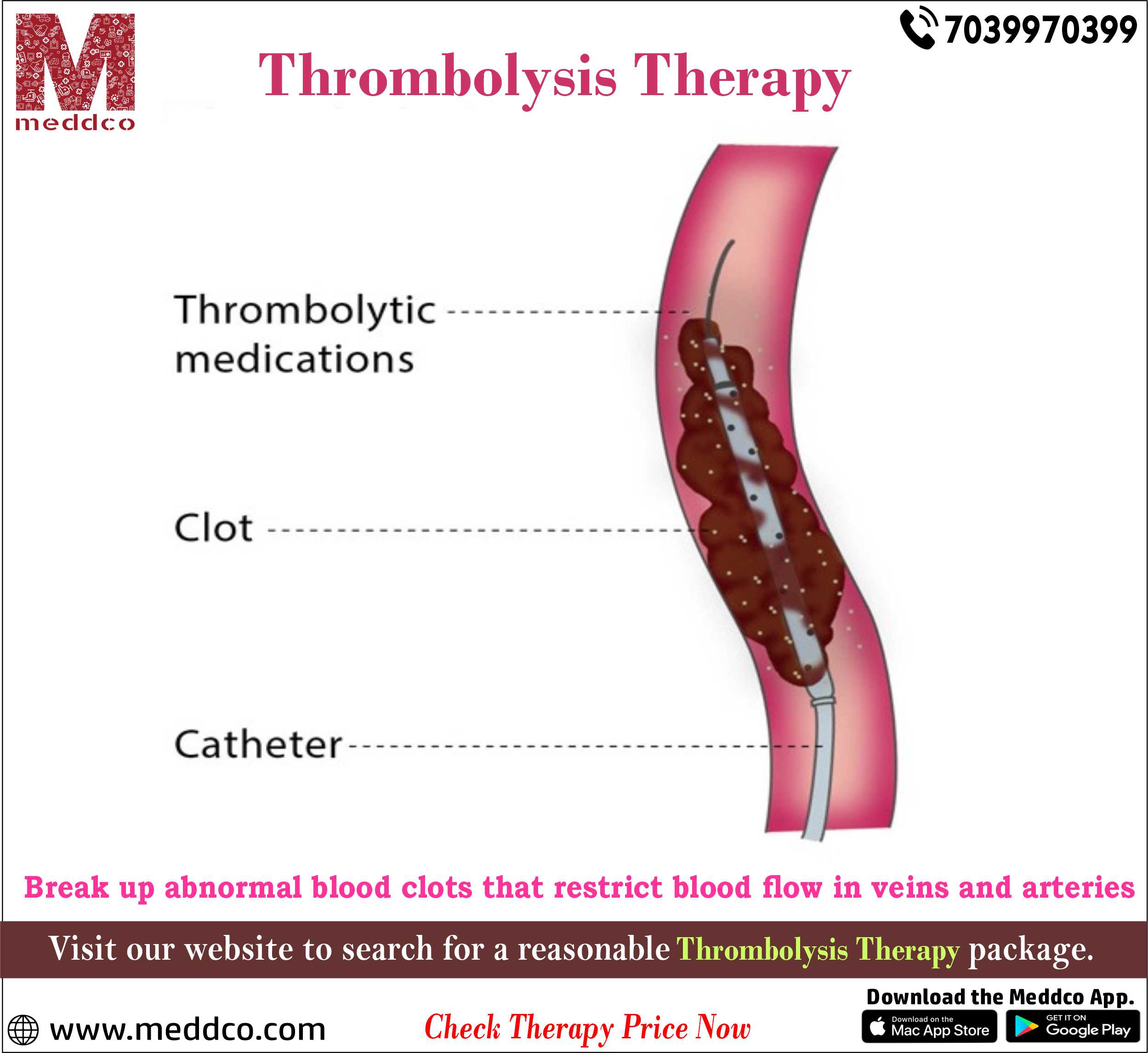 articles/Thrombolysis_Therapy.jpg