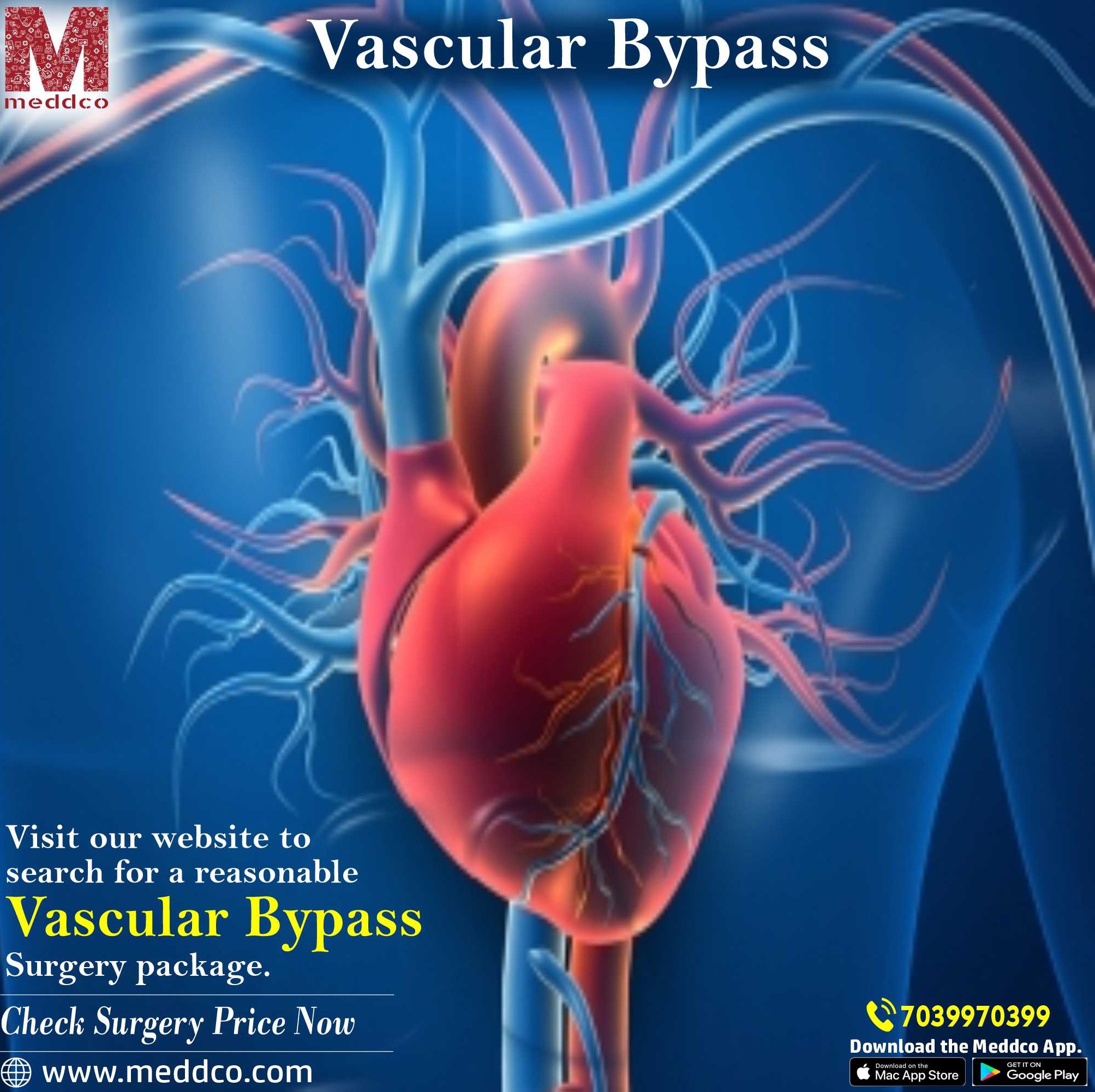 articles/Vascular_Bypass-.jpg