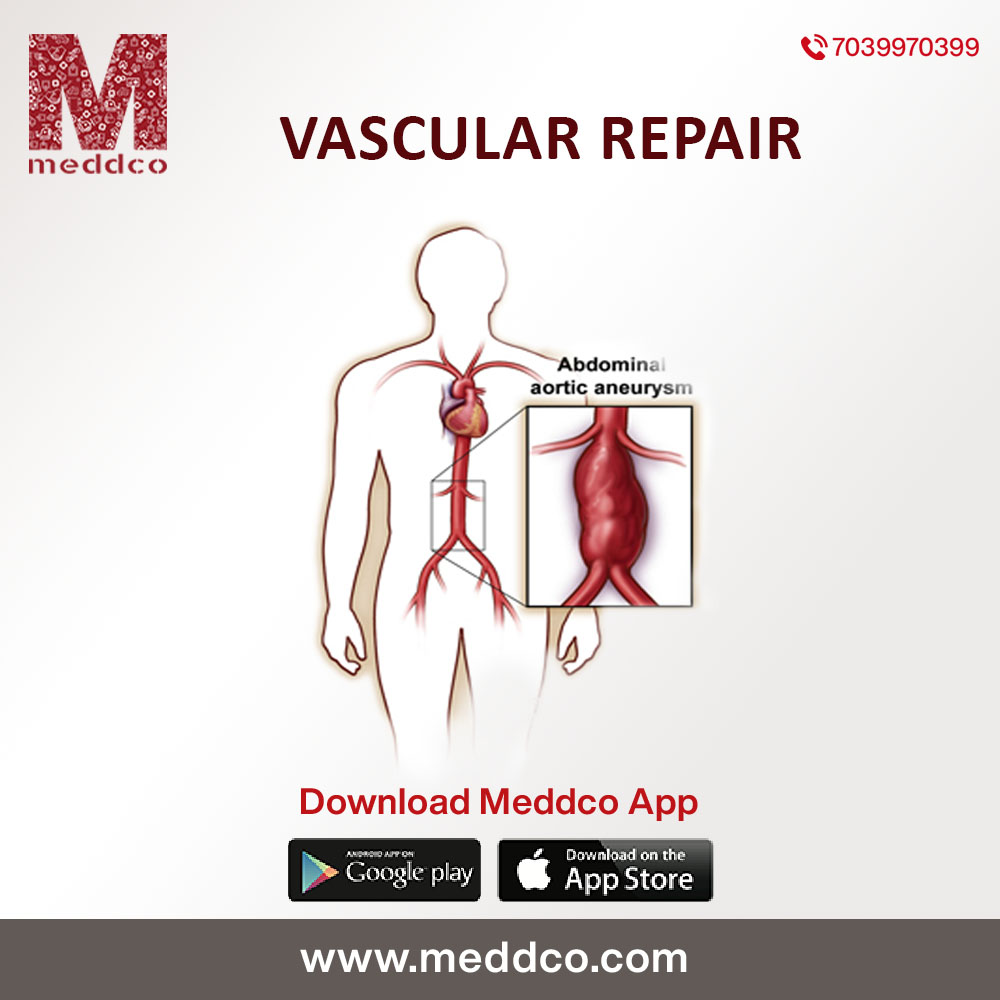 What is the procedure for vascular surgery?
