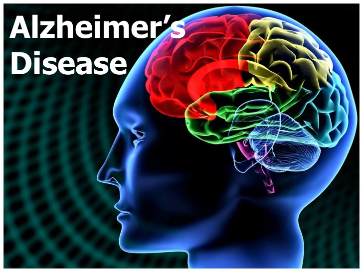 articles/alzheimers-disease-doctor-treatment.jpg