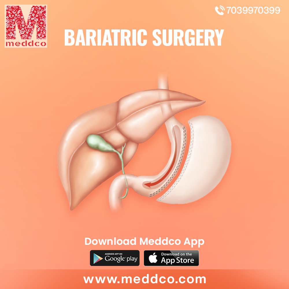 articles/bariatric_surgery_1_(1).jpg