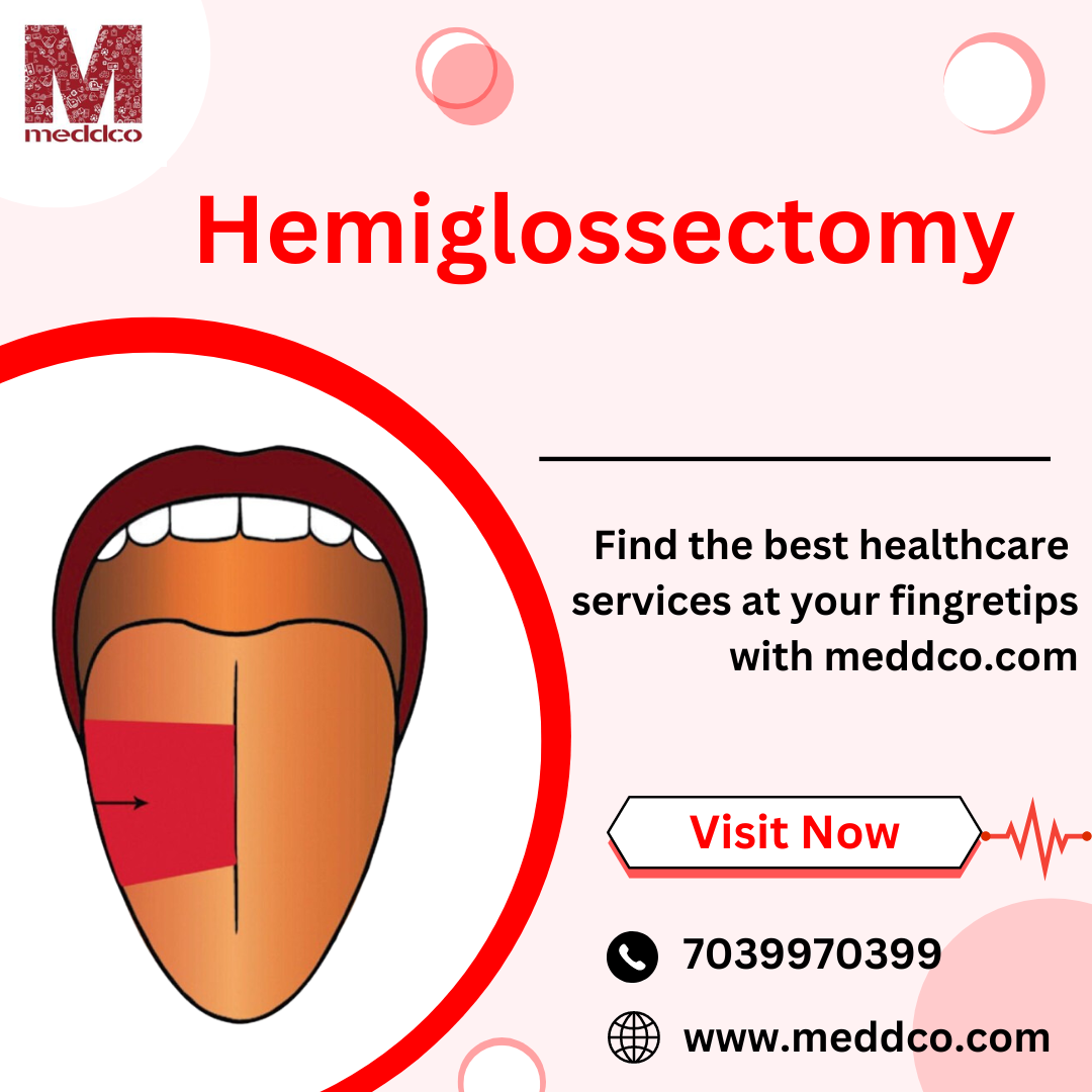 Hemiglossectomy: A Surgical Solution for Tongue Cancer