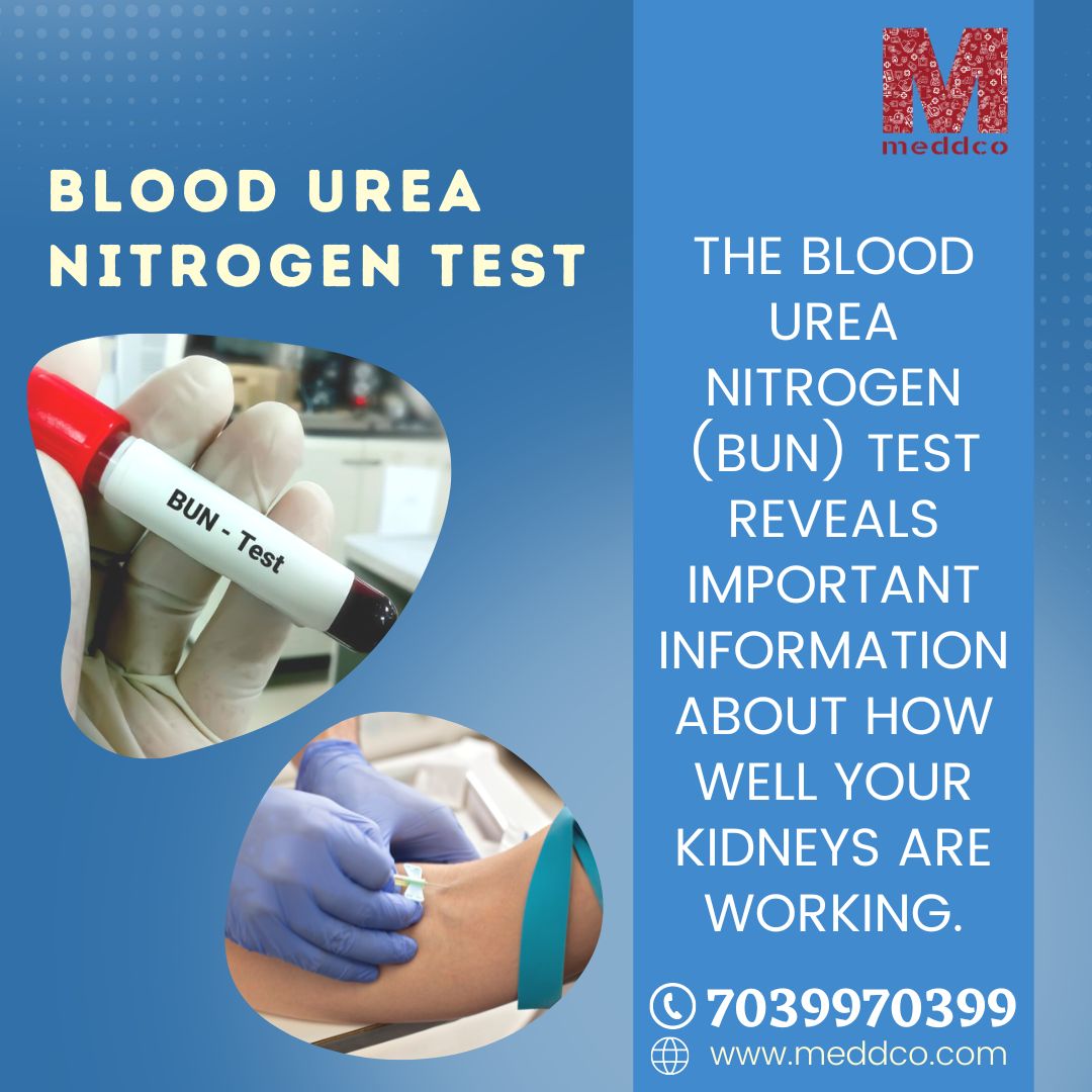 Blood Urea Nitrogen Test