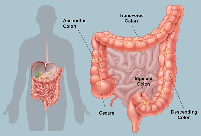 Colon Infection, Symptoms, Causes Diagnosis And Treatment