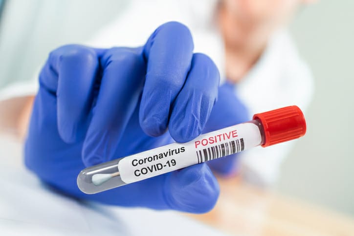 articles/coronavirus-covid-19.jpg