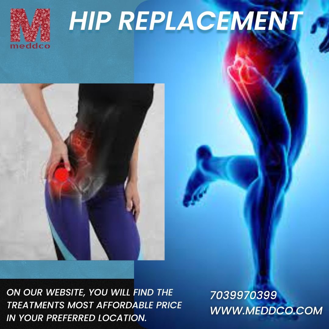 Mistakes One Should Avoid after a Hip Replacement Surgery