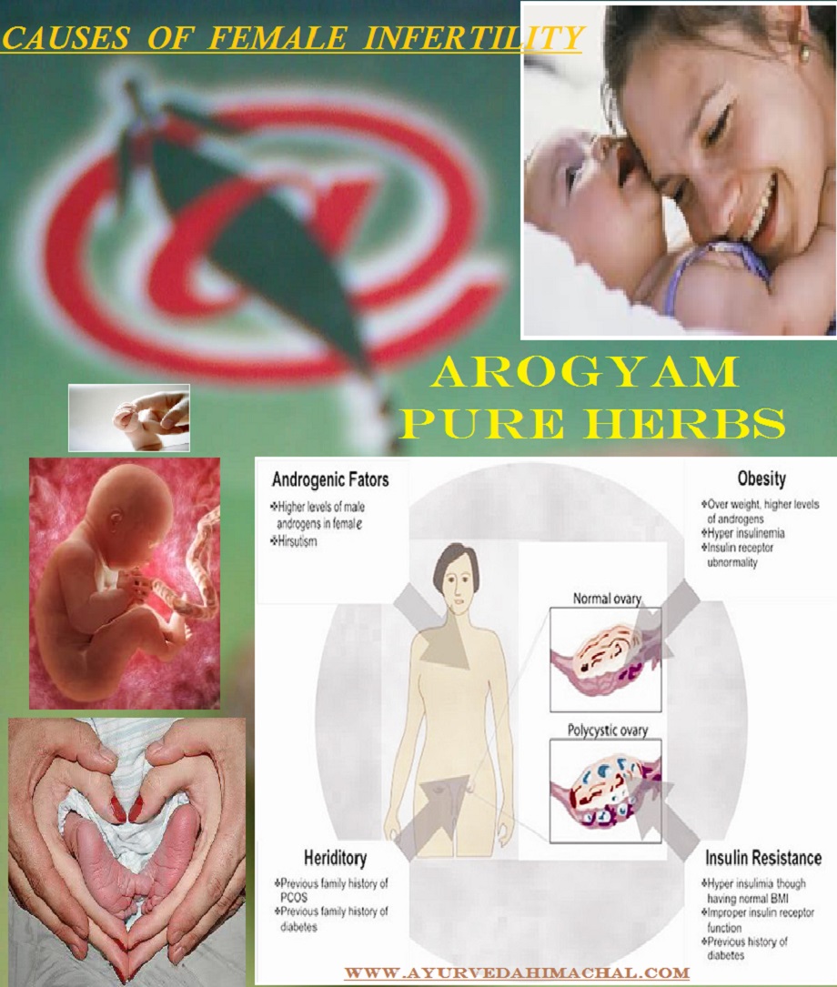 Ayurvedic Treatment For PCOS / PCOD