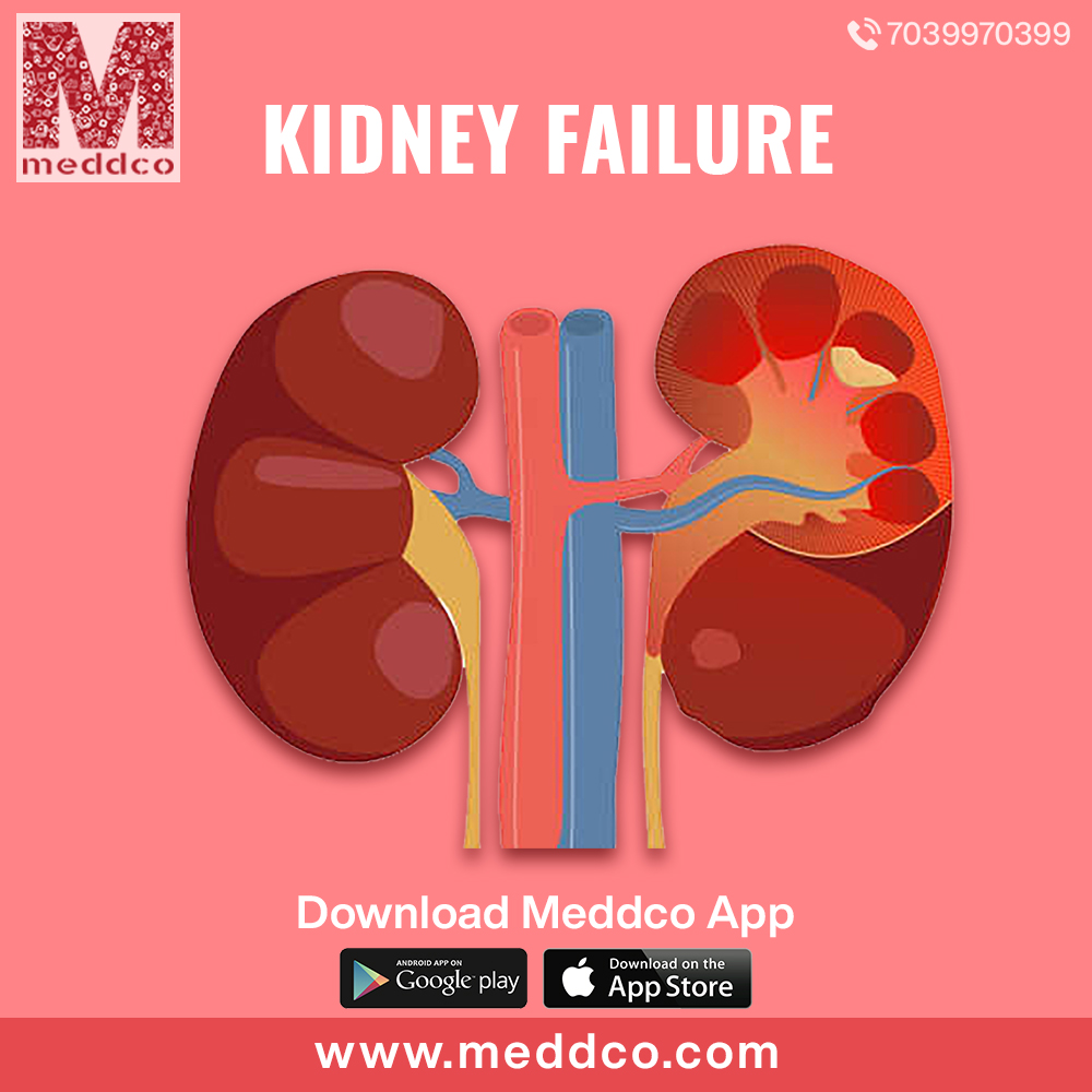articles/kidney_failure_1_(3).jpg