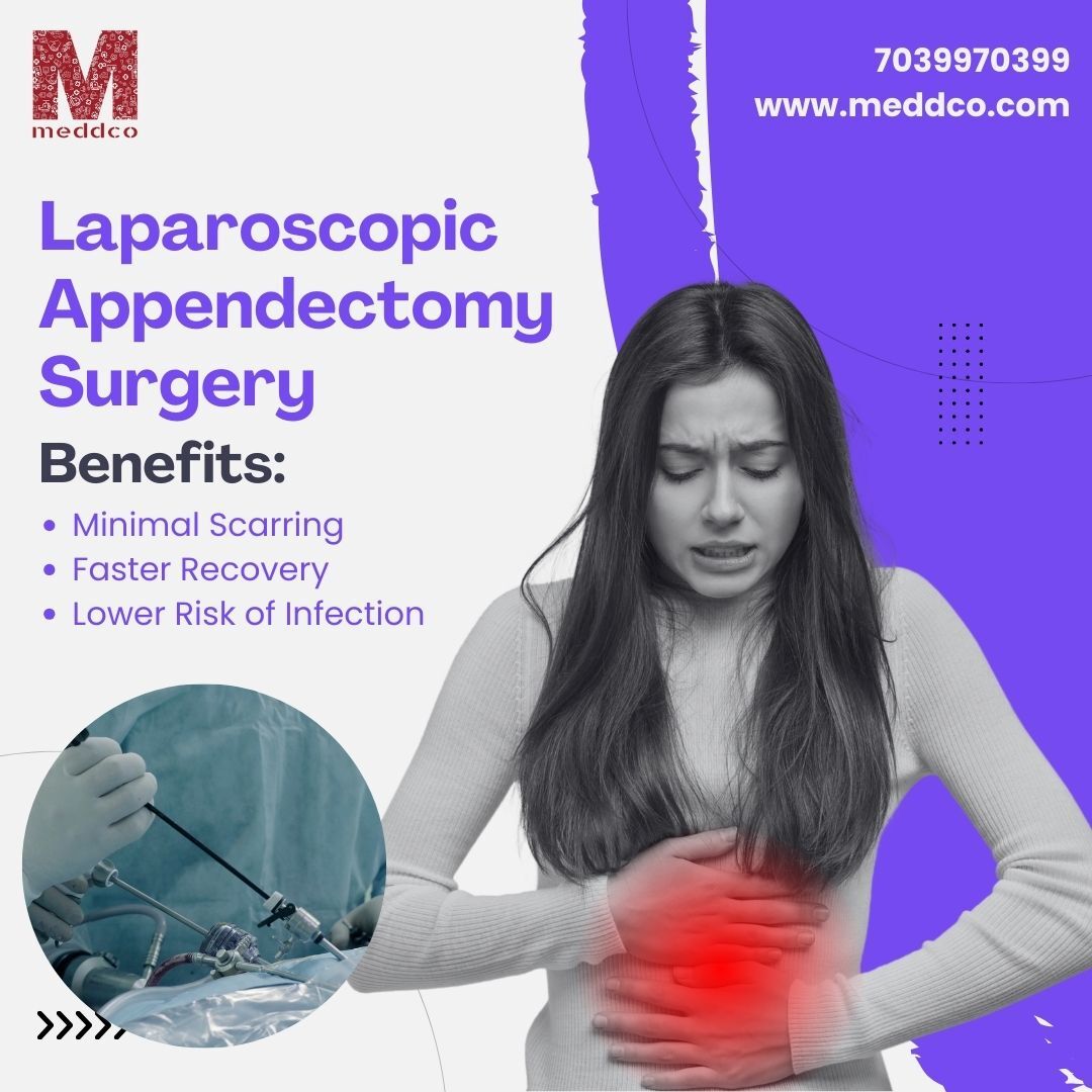 Laparoscopic Appendectomy surgery in Ahmedabad