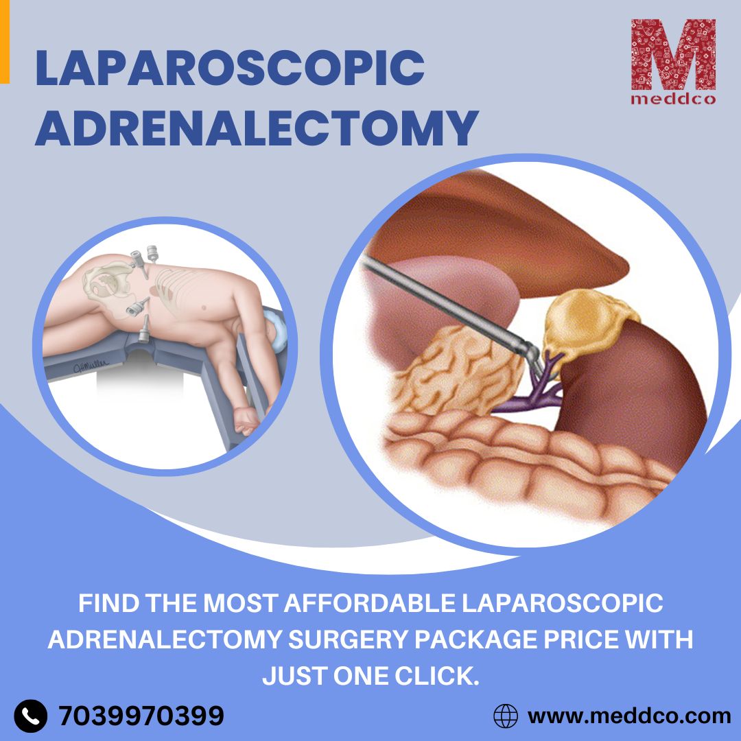 Abdominal Surgery With Laparoscopic Adrenalectomy : Symptoms, Side-Effects, Complications