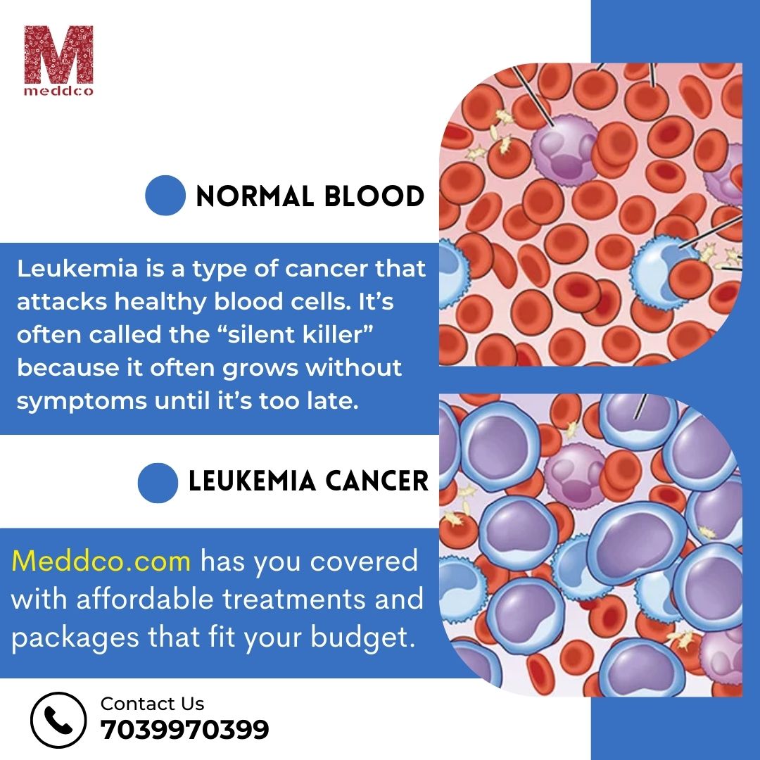 Cancer of the Blood: An information and educational blog about leukemia.
