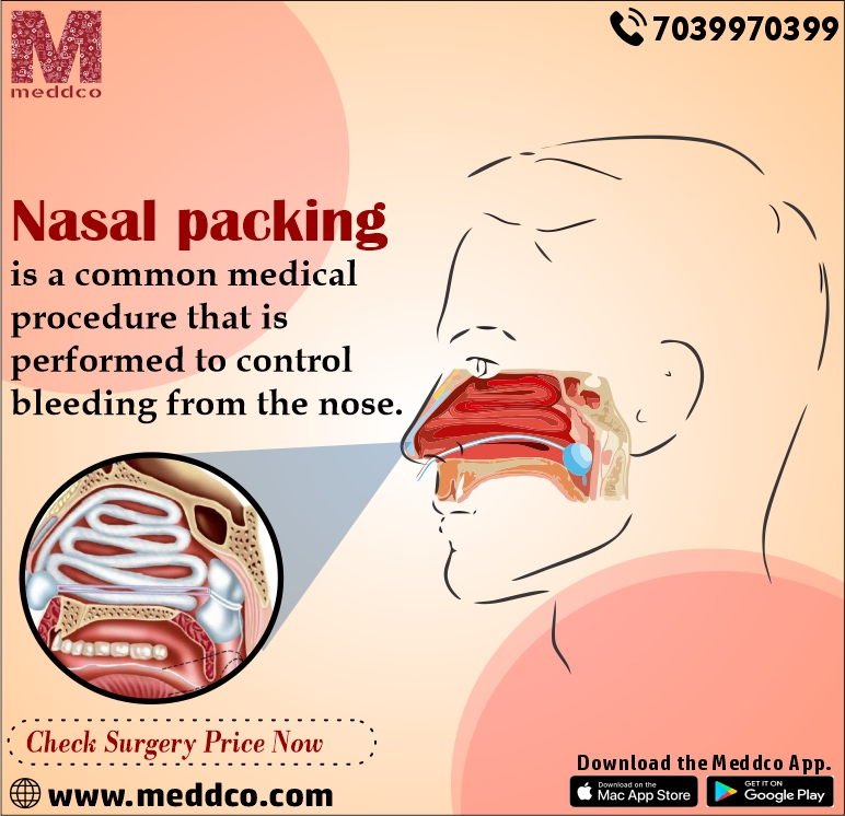 articles/nasal_packing.jpg