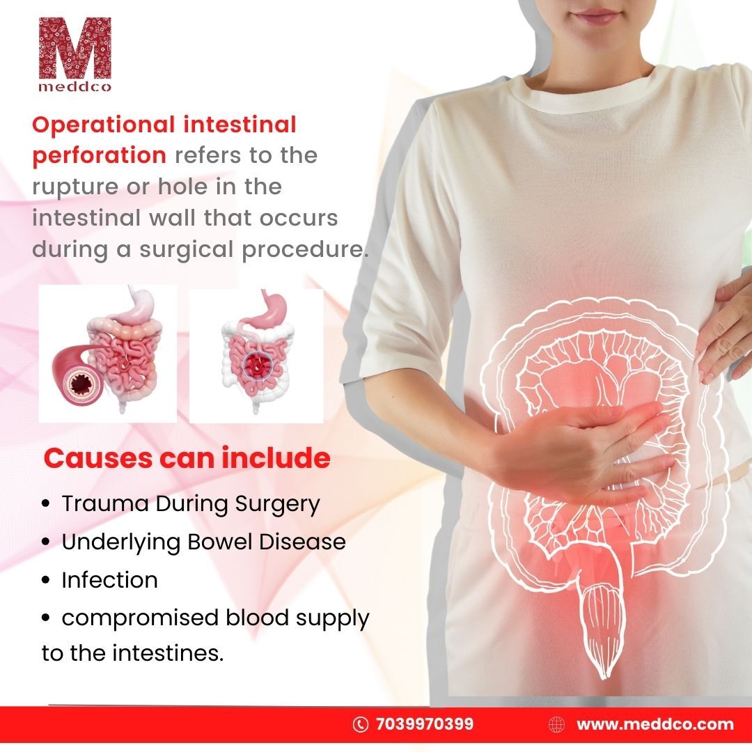 operational intestinal perforation cost in Pune
