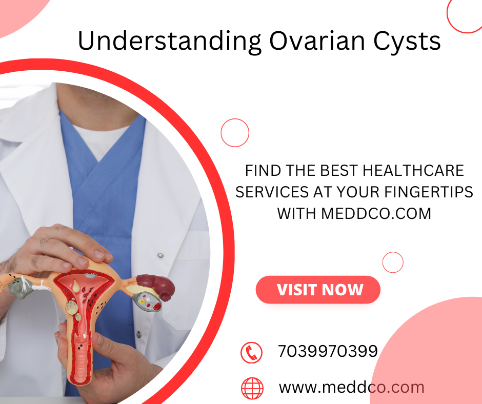 Ovarian Cysts - symptoms and treatment