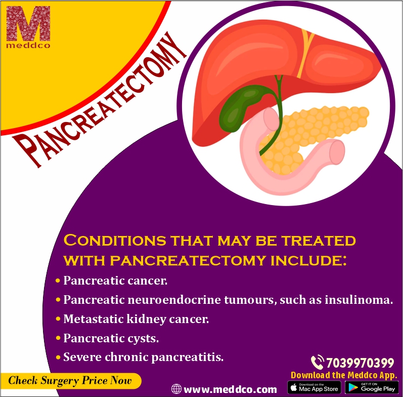 articles/pancreatetomy.jpg