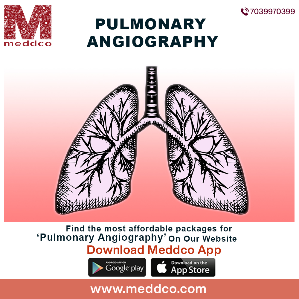 articles/pulmonary_angiography.jpg