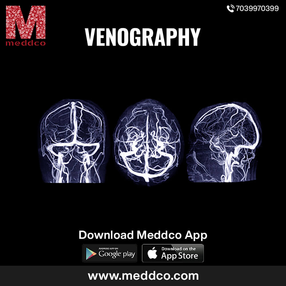 articles/venography_1.jpg